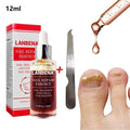 LANBENA Nail Repair Essence Nail Fungus Removal Anti Onychomycosis Feet Care Treatment With Foot File Nail Repair Liquid TSLM1|Nail Treatments