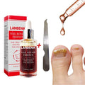 LANBENA Liquid Fungal Nail Repair Treatment With File Anti Fungus Nail Toe Repair Serum Nourishing Nail Care Essence TSLM1|Nail Treatments