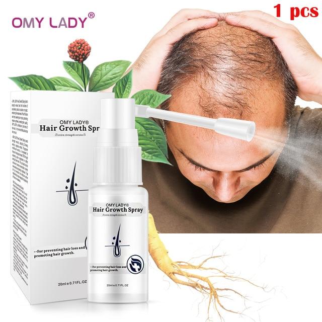 OMY LADY Anti Hair Loss Hair Growth Spray Essential Oil Liquid For Men Women Dry Hair Regeneration Repair Hair Loss Products|Hair Loss Products