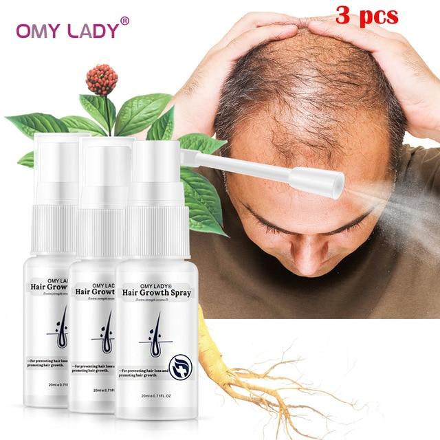 OMY LADY Anti Hair Loss Hair Growth Spray Essential Oil Liquid For Men Women Dry Hair Regeneration Repair Hair Loss Products|Hair Loss Products