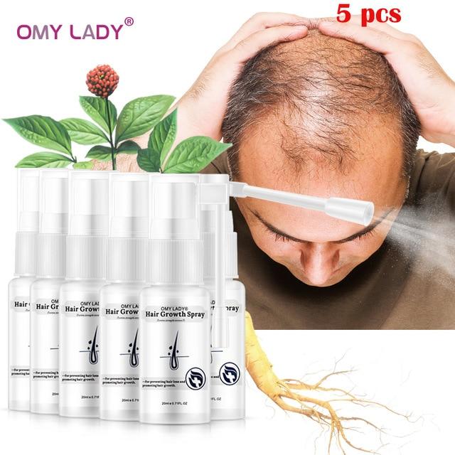 OMY LADY Anti Hair Loss Hair Growth Spray Essential Oil Liquid For Men Women Dry Hair Regeneration Repair Hair Loss Products|Hair Loss Products